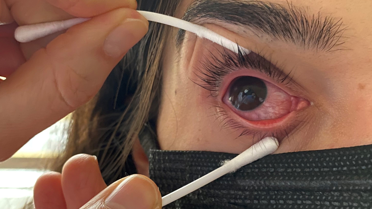 Çok hızlı yayılıyor, görme kaybına bile yol açabilir!