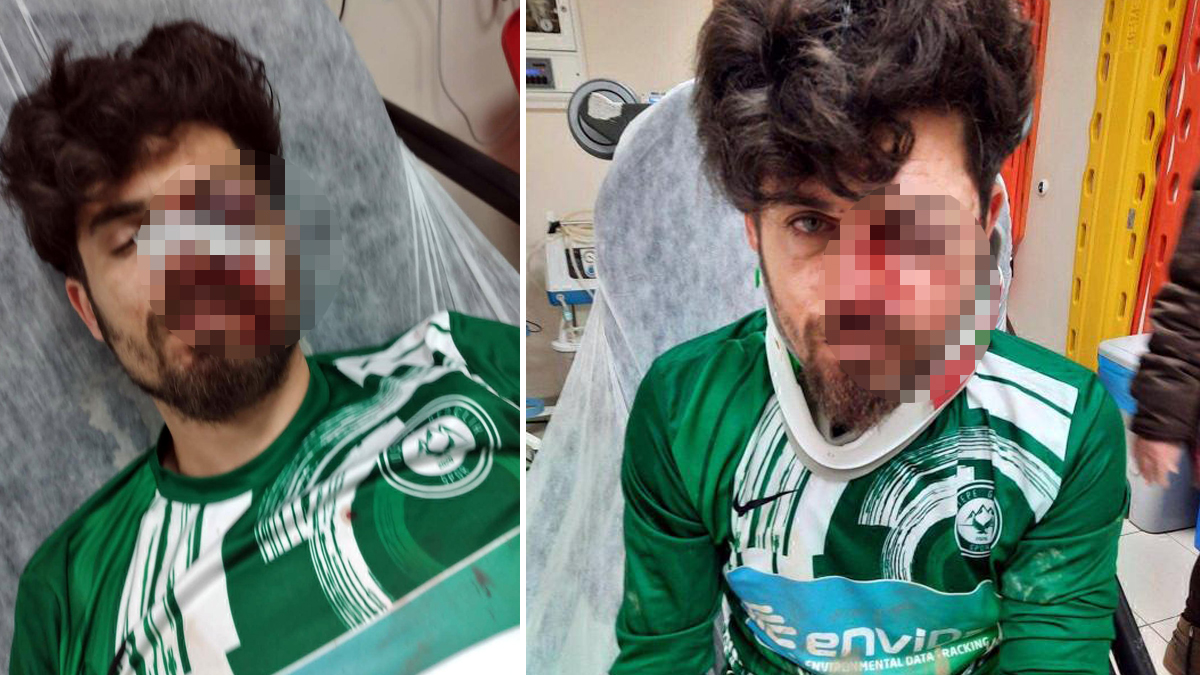 Bunun adı cinayete teşebbüs! Kırmızı kart gördüğü için rakibinin yüzünü tekmeledi