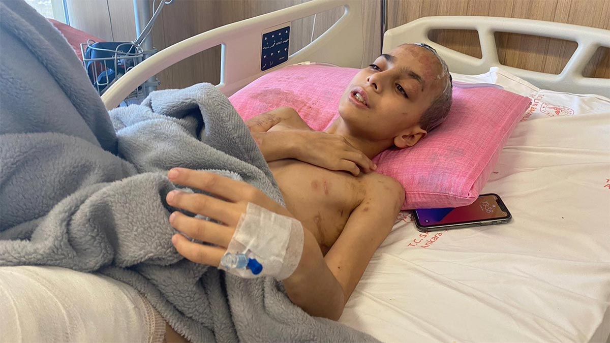 Köpeklerin saldırısına uğrayan çocuk 9 ameliyat geçirdi