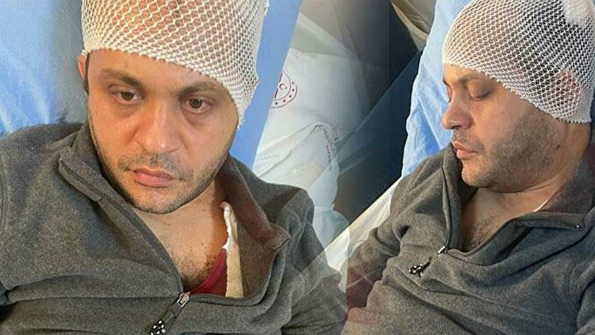 Gaziantep'te doktora mermerli saldırı: Saldırgan gözaltında