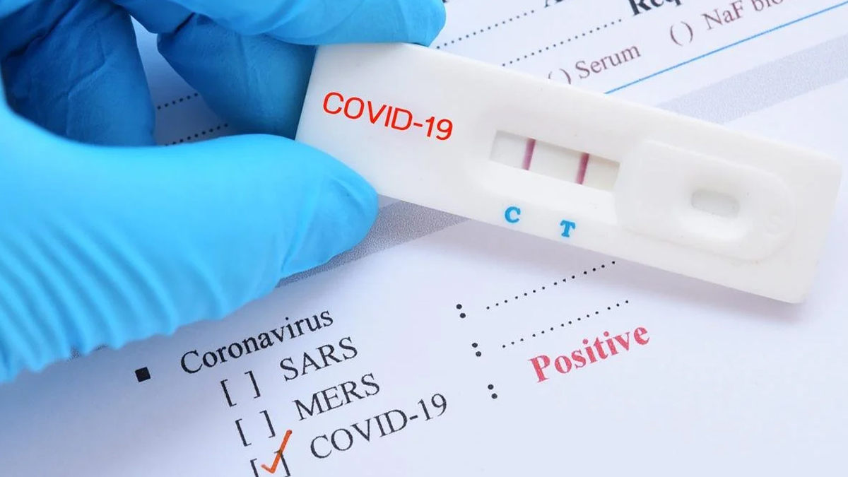 24 Mart Güncel Koronavirüs Tablosu açıklandı