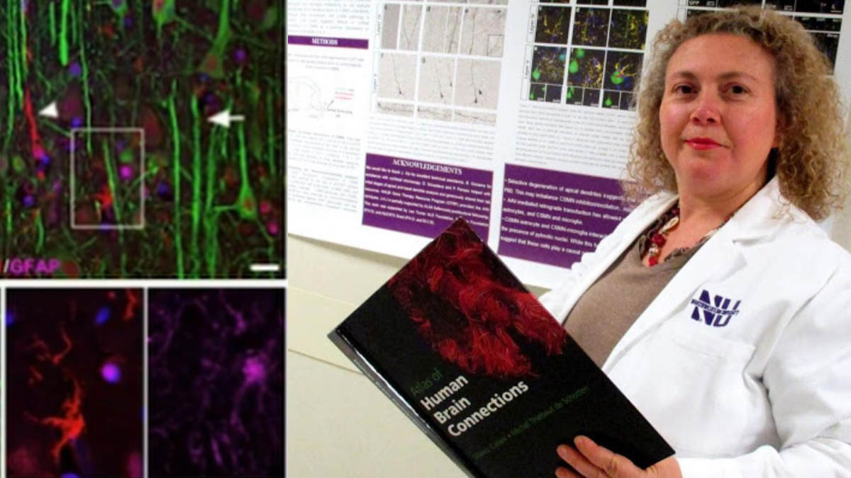 Doç. Dr. Hande Özdinler ölü beyin hücresini yeniden canlandırmayı başardı