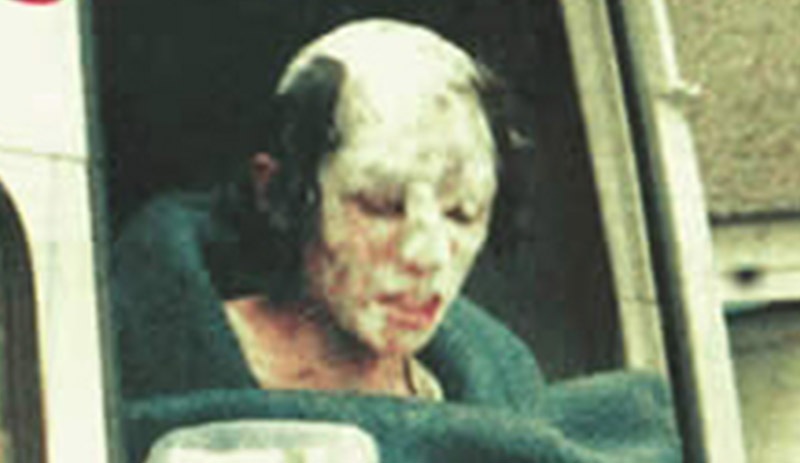 'Hayata Dönüş Operasyonu'ndan yaralı kurtulan Birsen Kars yaşamını yitirdi