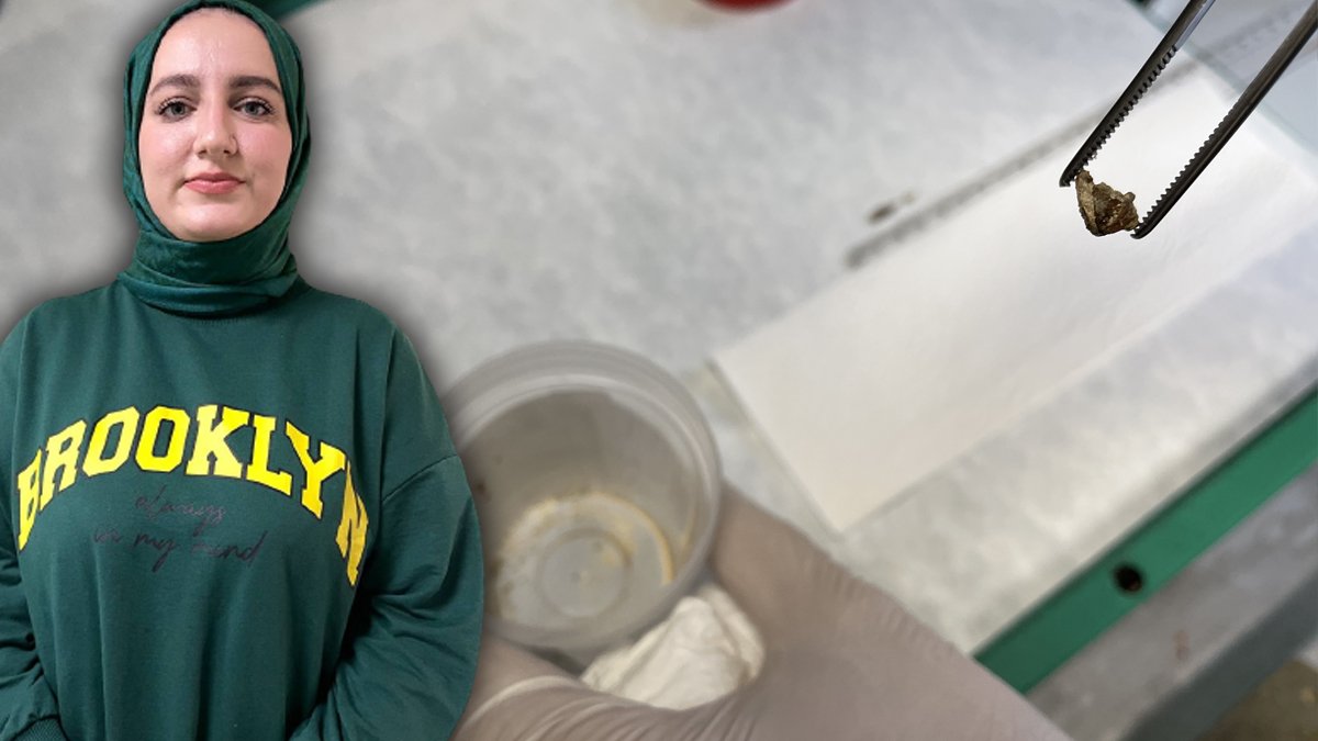 Kanser sanılan hastanın soluk borusundan çıkan şoke etti