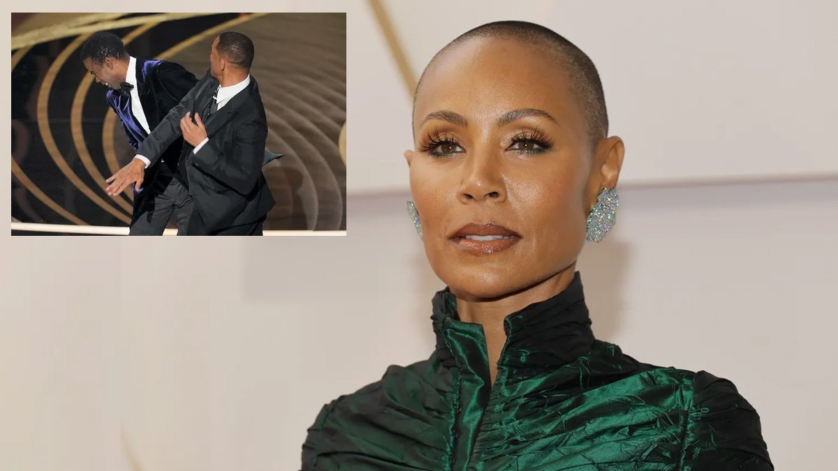 Smith'in attığı tokatın ardından dünyanın konuştuğu hastalık: Alopesi