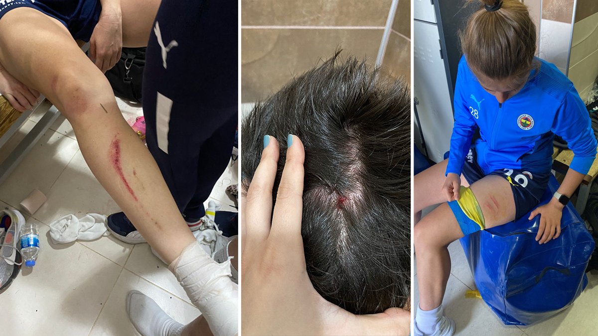 Amed SF - Fenerbahçe maçında saha karıştı