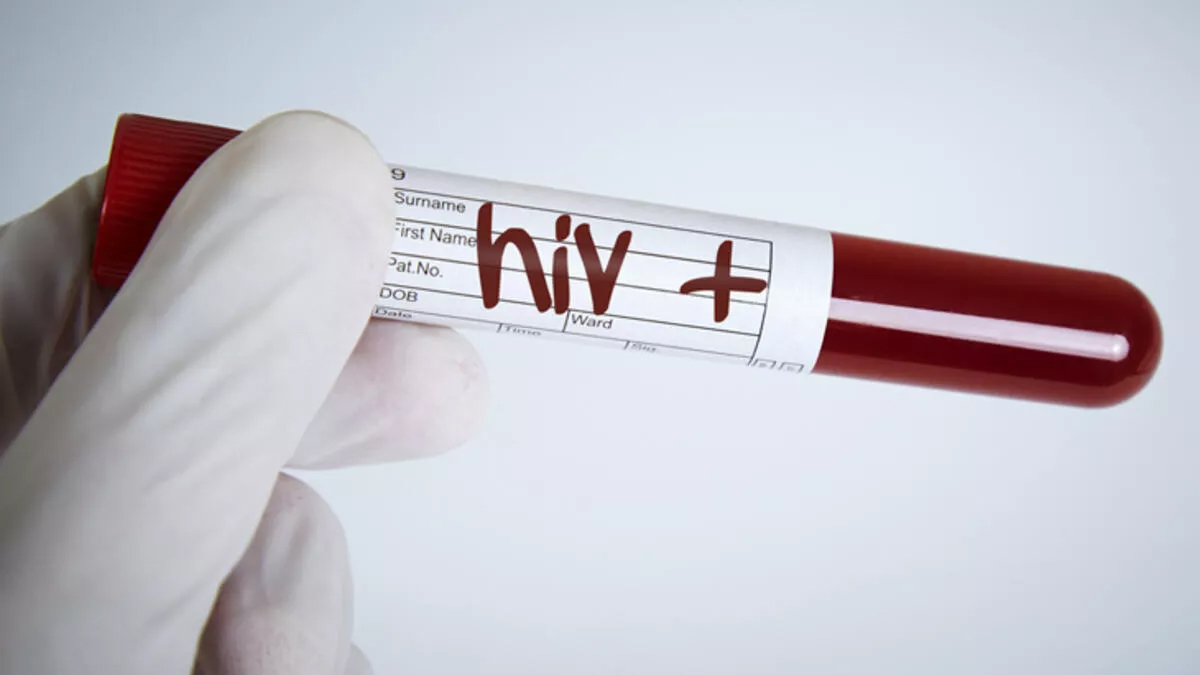 CİSÜ: HIV enfeksiyonunun son 10 yılda yüzde 460 arttığı tek ülke Türkiye