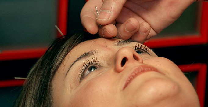 Depresyon ve bağımlılık tedavisine doğal destek: Akupunktur