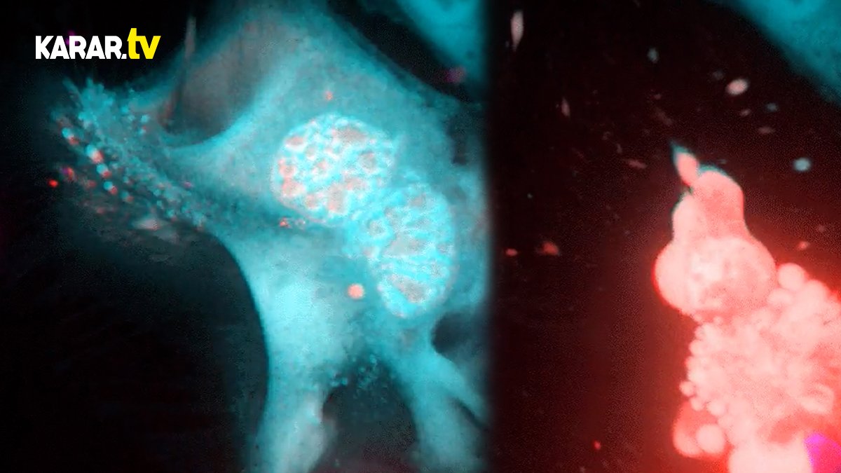 Öldürücü T hücresinin, kanser hücrelerini yok etmesi görüntülendi