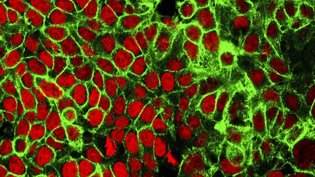 Kanser hastalığında kişiselleştirilmiş tedaviye kapı aralayacak önemli keşif