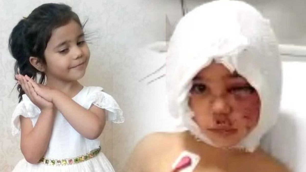 Asiye'ye pitbull saldırısı davasında yeni gelişme