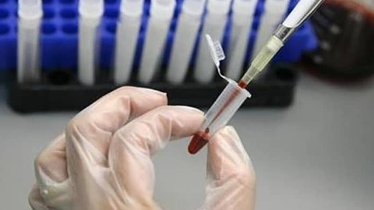 Prof. Dr. Mehmet Ceyhan: 'Gizemli virüs' Türkiye'de görülmedi diyemeyiz