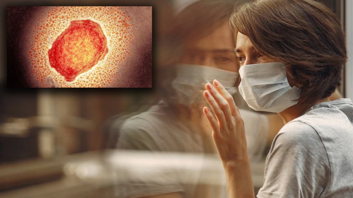 İlk zorunlu karantina! 'Maymun çiçeği' bir ülkeyi kapattı