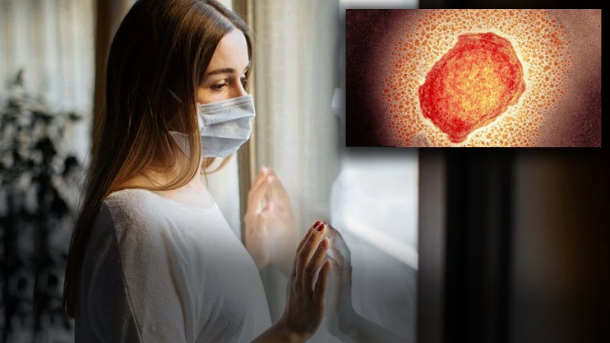 Karantina geri mi geliyor? Bilim Kurulu üyesinden korkutan 'maymun çiçeği' açıklaması: İlk vaka tespit edildiğinde...