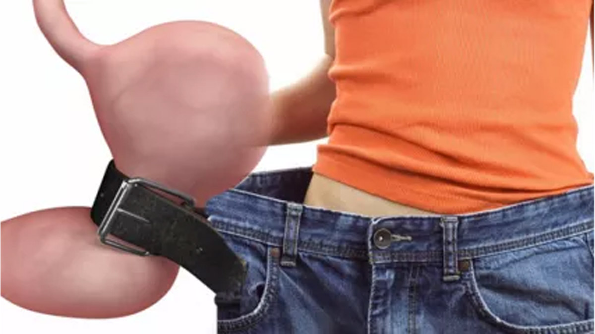 Mideye Kelepçe Ameliyatının Beklenmedik Bir Faydası! O Amansız Hastalığa Yakalanma İhtimali Çok Azalıyor