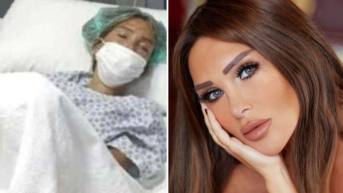 Ünlü şarkıcıya 'sünnet derisi' dopingi! Estetikte çıtayı yükselten Seren Serengil'den tepki çeken yöntem