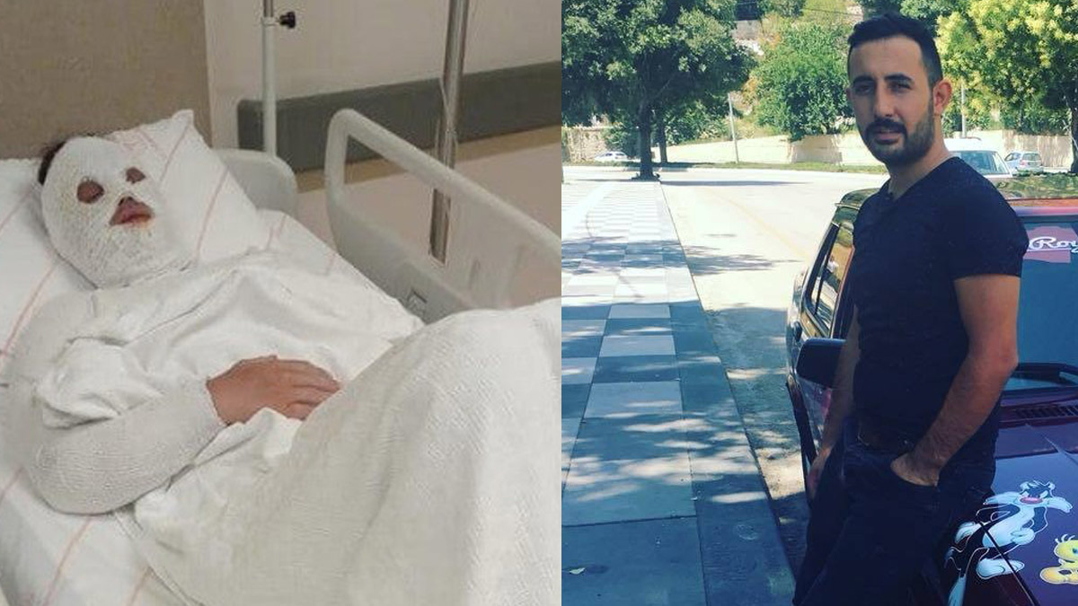 'Su saatine bakacağım' diyerek kapıyı açtırdı! Eski nişanlısına kezzap attı