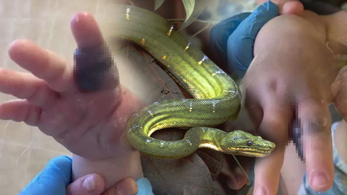 Engerek yılanı sokan bebeğin mucizevi kurtuluşu! Annesi elini görünce şoku yaşadı