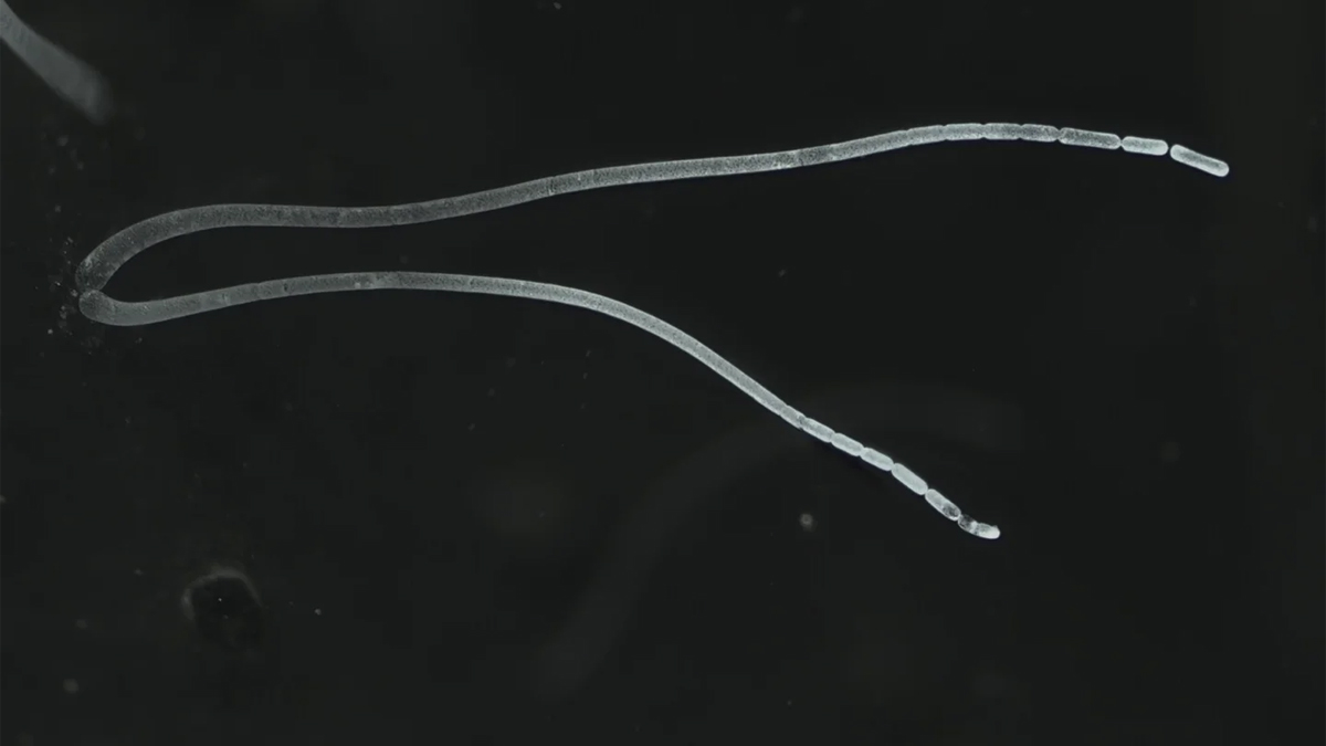 Dünyanın en büyük bakterisi bilim dünyasını şoke etti: Bakterilerin 'Everest'i