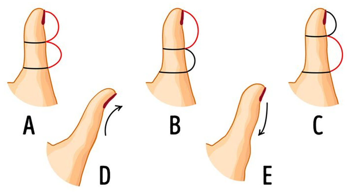 Başparmağınız Karakterinizi Ele Veriyor! İşte Başparmağınızın Şekline Göre Kişilik Testi