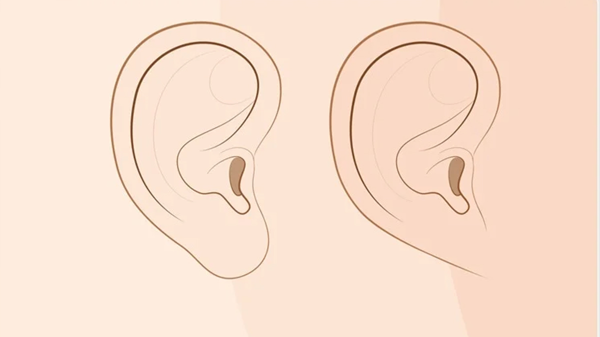 Kulağınızın Şekli Etnik Kökeninizi Söyler Mi? İşte Kulak Memelerinin Söyledikleri...