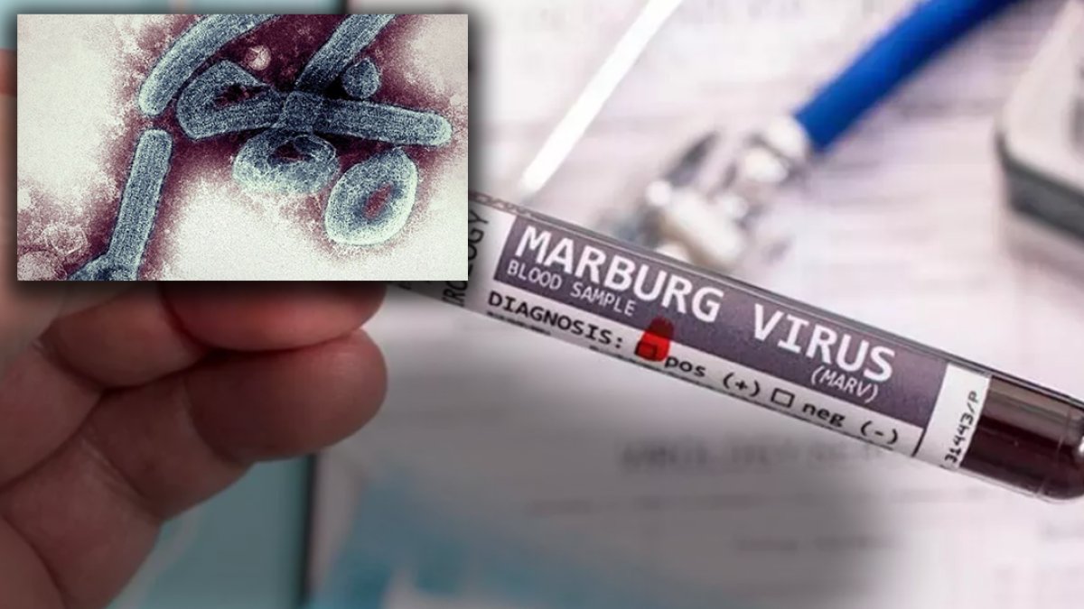 Koronavirüs, maymun çiçeği derken yeni tehlike! 2 kişi hayatını kaybetti