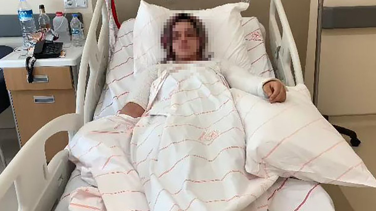 Eski nişanlısının kezzaplı saldırısına uğrayan genç kadın konuştu: Sıvı kapının boyasını dahi eritmiş!