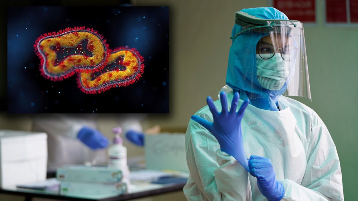 Maymun çiçeği alarm veriyor! Dünya Sağlık Örgütü'nden küresel acil durum ilanı