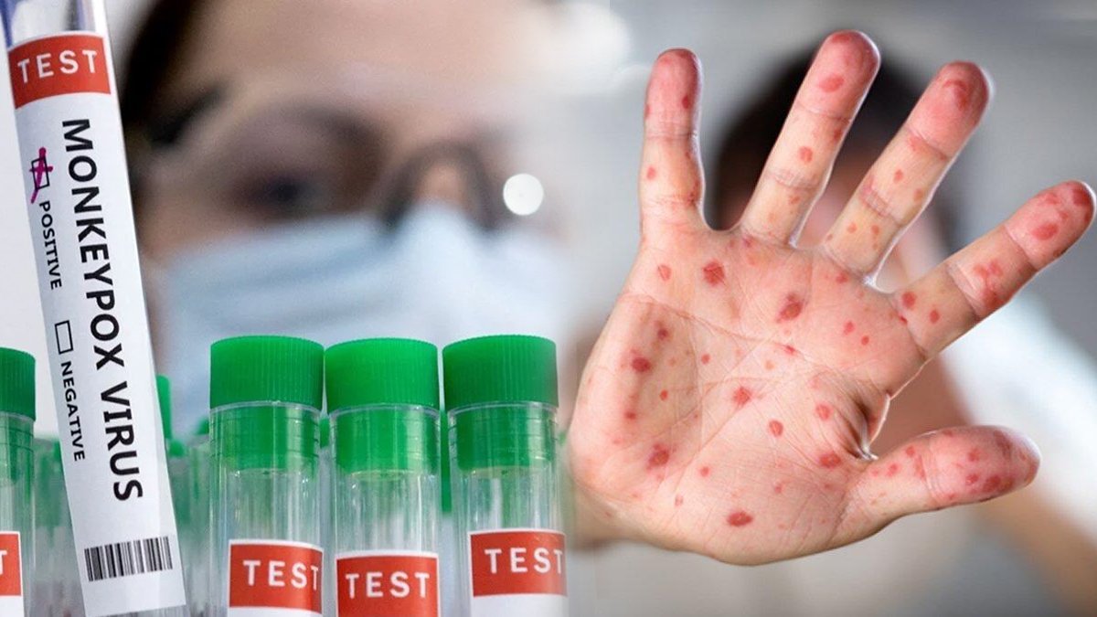 Maymun çiçeği aşısına ilk onay AB'den: DSÖ 'acil durum' ilan etmişti