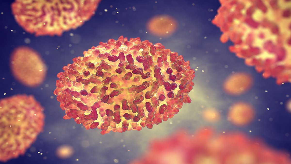 DSÖ, maymun çiçeği vakasıyla temasta olanları uyardı: Bir süre seyahat etmeyin