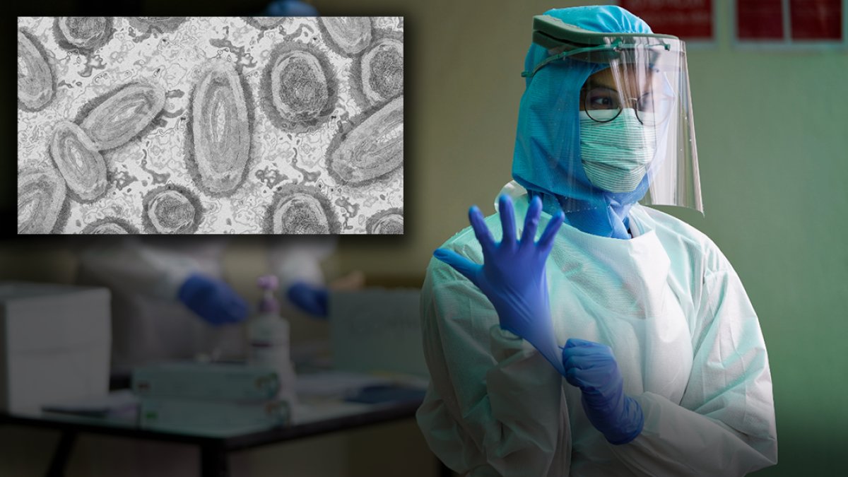 Maymun çiçeği için acil durum ilan eden DSÖ, bu kez uyardı: Zaman giderek daralıyor