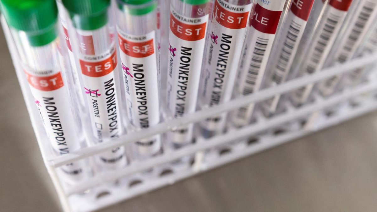 Bir ülkede daha maymun çiçeği can aldı