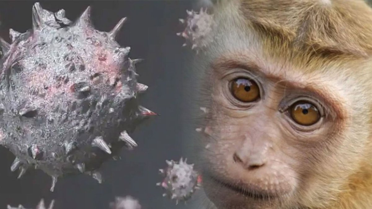 Hızla yayıldı: Maymun Çiçeği kaynaklı ölümler artıyor