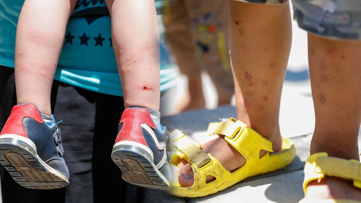 Dikkat bu sivrisinekler ölüm taşıyor! İstanbul'da ‘Aedes’ tehdidi