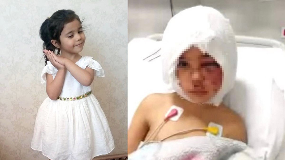 Pitbull saldırısına uğrayan Asya'nın ailesinden 'istismar' suçlamasına yanıt: Oyun oynuyorduk