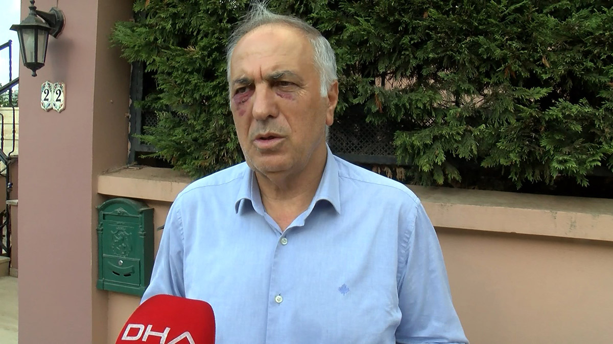 Saldırıya uğrayan Kartal Cemevi Başkanı yaşananları anlattı