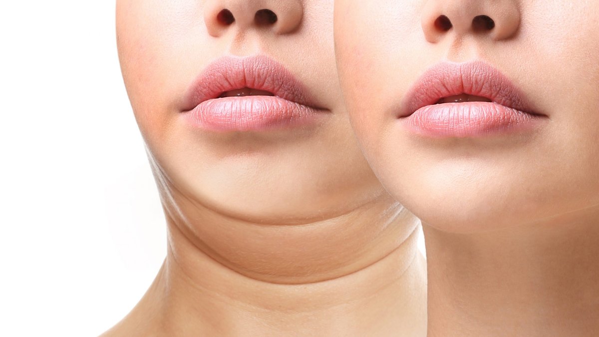 Gıdınızdan ve Tombul Yanaklardan Kurtulun! İşte Gıdınızı Anında Ortadan Kaldıran O Yöntem