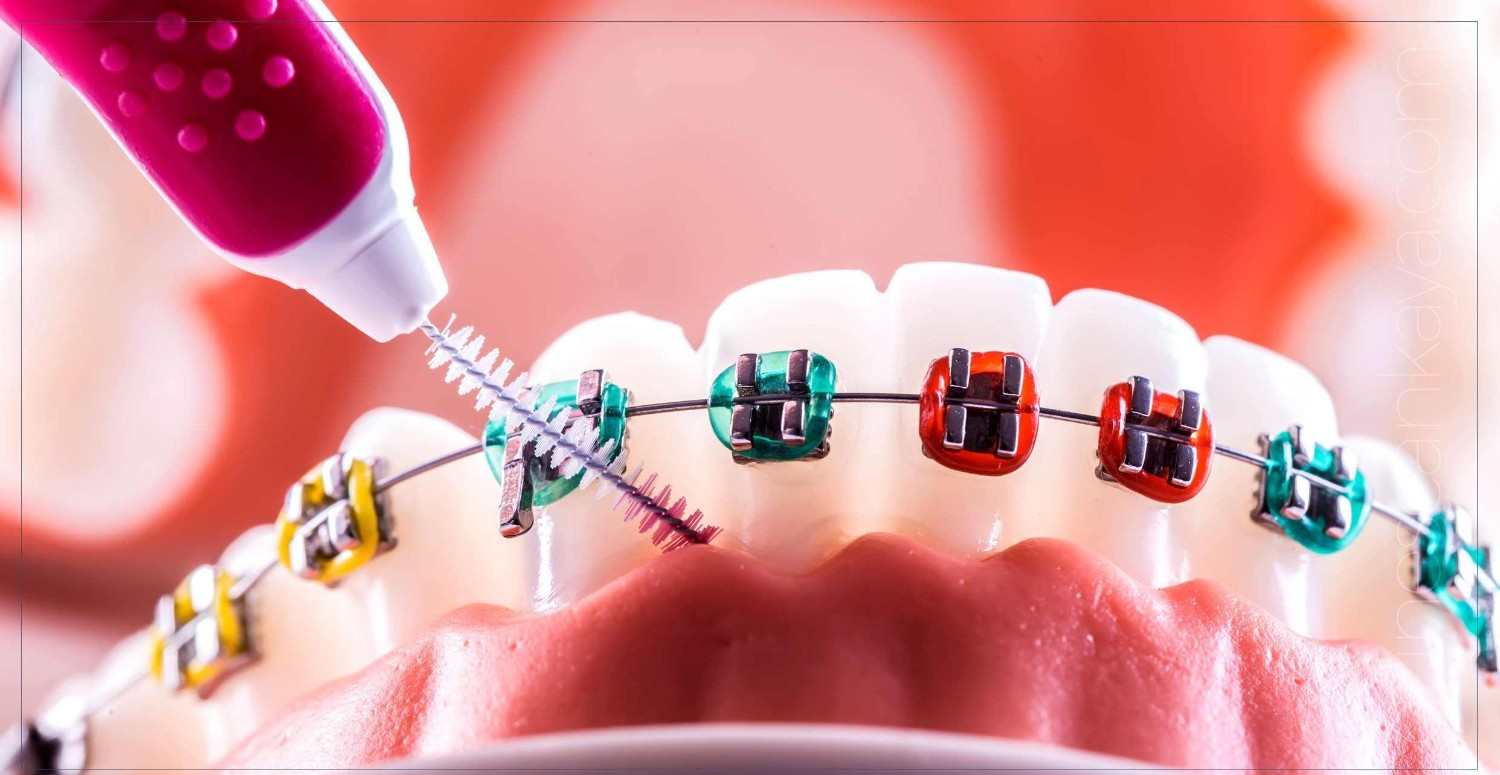 Ortodontist uzmanının görevleri nedir, ne kadar kazanır? Ortodontist olmak için gerekenler