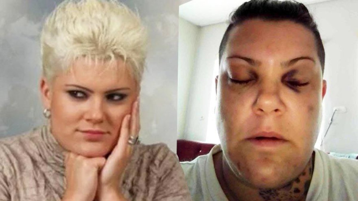 Popstar Evren Mevlanaoğlu, evinin önünde saldırıya uğradı