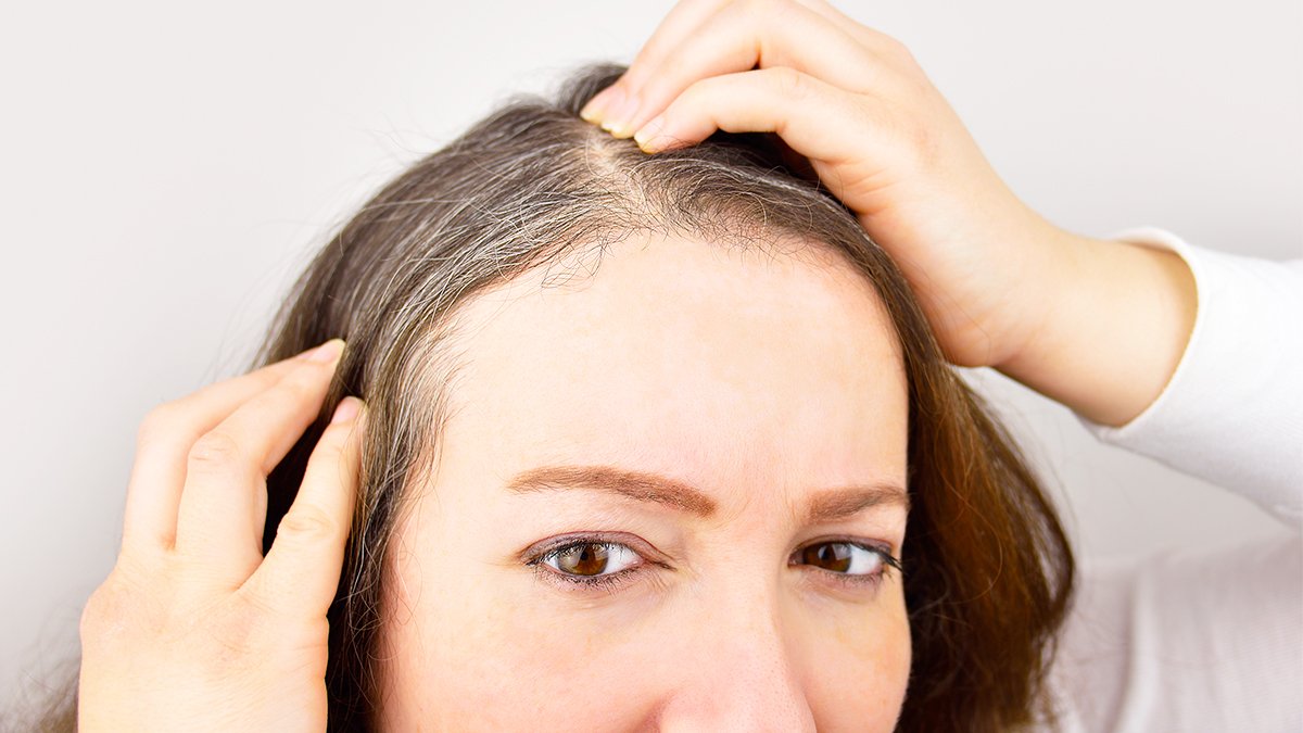 Saçlarınız Genç Yaşta Beyazlıyorsa Bu Hastalıklar Olabilir! İşte Saçları Genç Yaşta Beyazlatan O Rahatsızlıklar