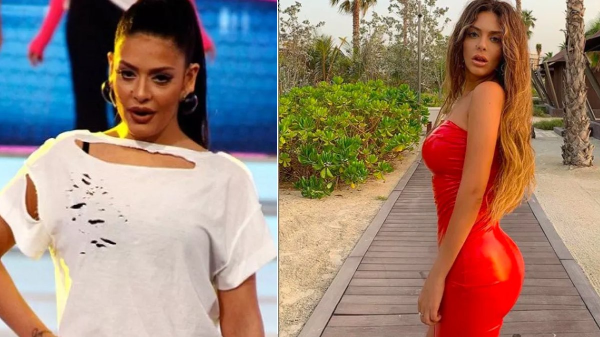 Bakan Başını Çeviriyor! İşte Benim Stilim Yağmur Taktaş  Estetikten Sonraki Pozlarıyla Olay Oldu