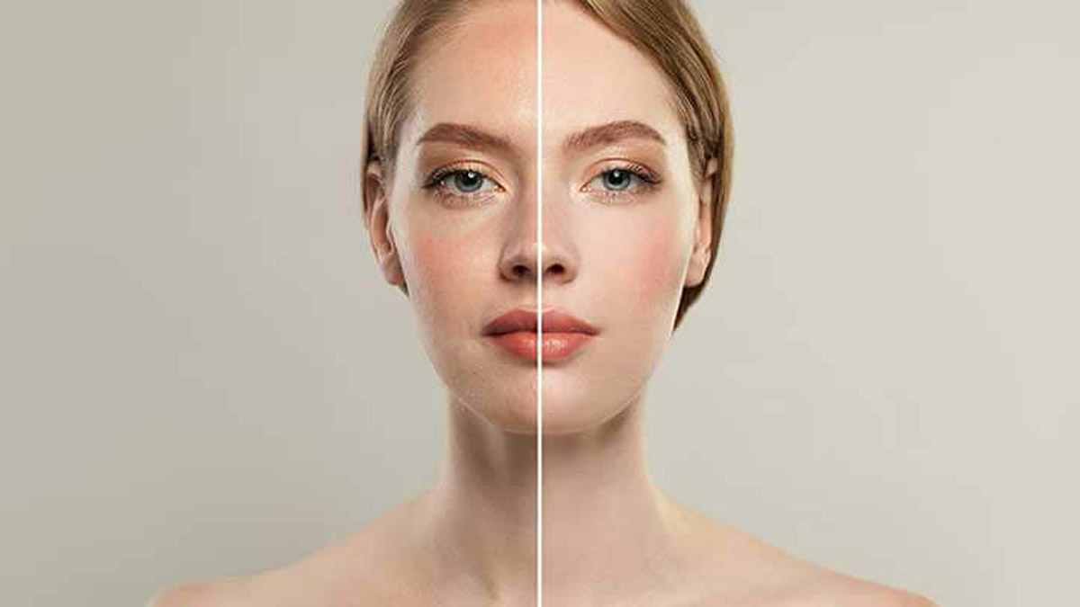 Cilt Tonunuzu Eşitlemek İçin Verdiğimiz Altın Değerinde Öğütlere Kulak Verin Elmas Gibi Bir Cilde Sahip Olun