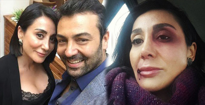 Oyuncu Saruhan Hünel "Sevgilisine dayak" iddiasıyla hakim karşısında