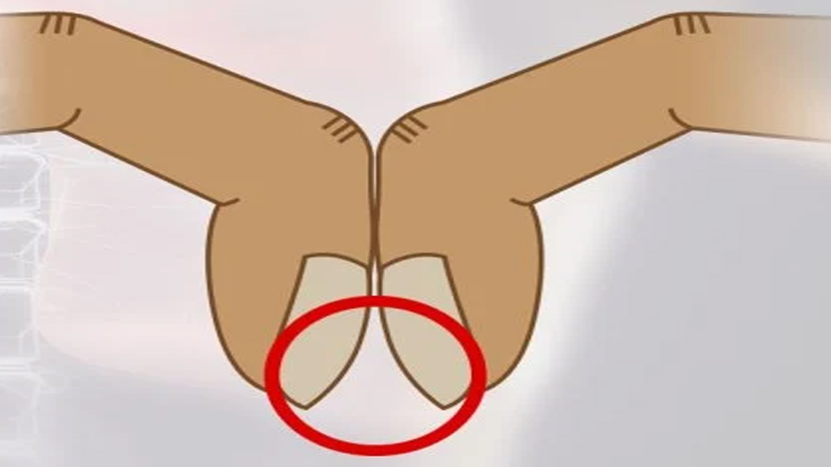 Tırnaklarınız resimdeki gibiyse kansersiniz! Yüzde 80 - 90 doğru çıkan tırnak testini hemen yapın...