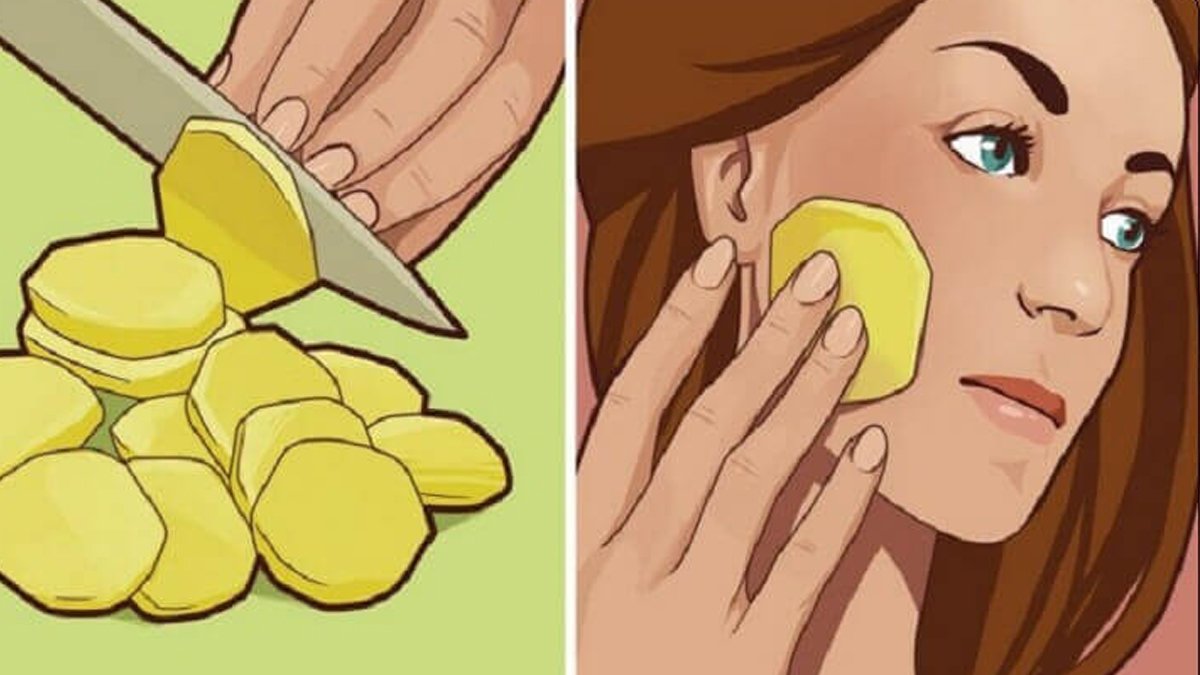 Her sabah yüzünü patates dilimiyle ovuyor! Nedenini öğrenince siz de aynısını yapmaya başlayacaksınız!