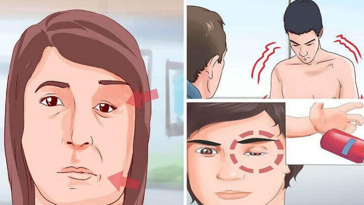 Fazla uyumayın! Felç geçirmeden bir ay önce vücudunuz size bir sinyal veriyor!