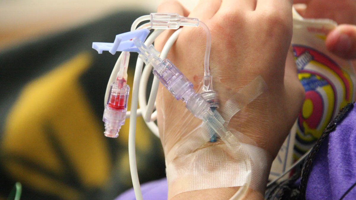 Kemoterapi sürecinde yeni umut: Damar yerine deri altı kullanılabilir