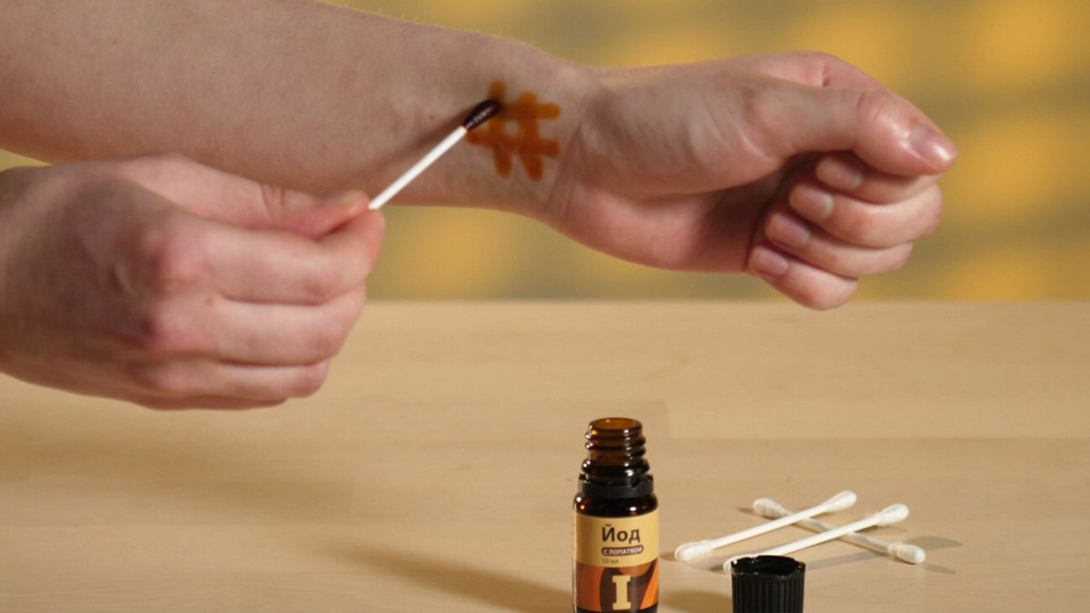 Bileğine iyot sür sonuç yüzde 100 doğru çıkacak! Evde sağlığı test etmenin dahiyane yolu...