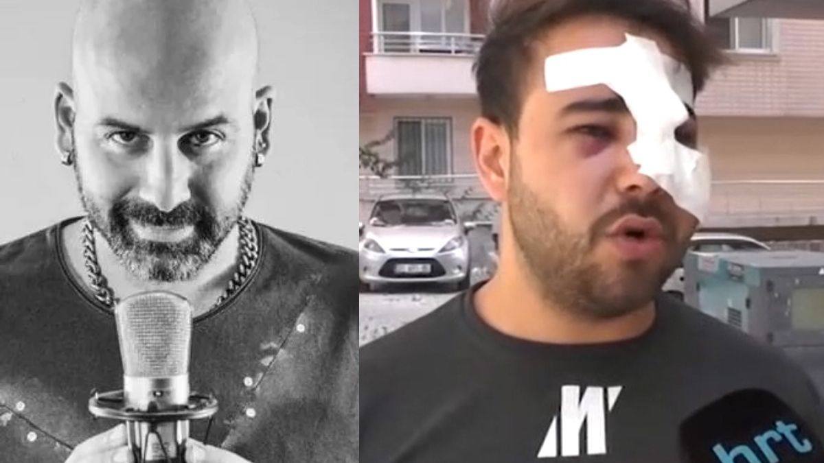 Bir Onur Şener vakası daha... İstek parçayı çalmadı diye kafasında şişe kırdılar
