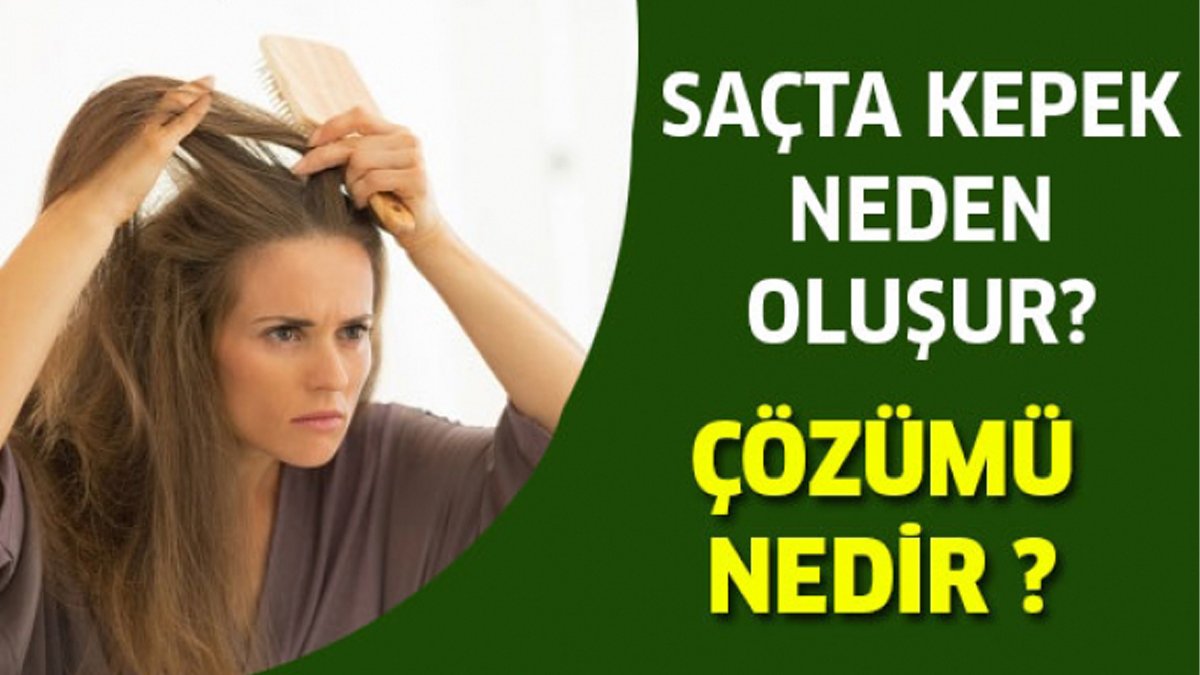Özgüven düşüklüğüne sebep olan kepekler kabusunuz olmasın! İşte kepek için doğal çözümler